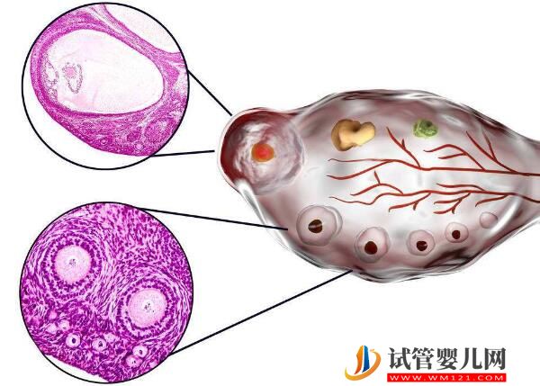 去老挝做试管婴儿过程痛苦吗？(图2)