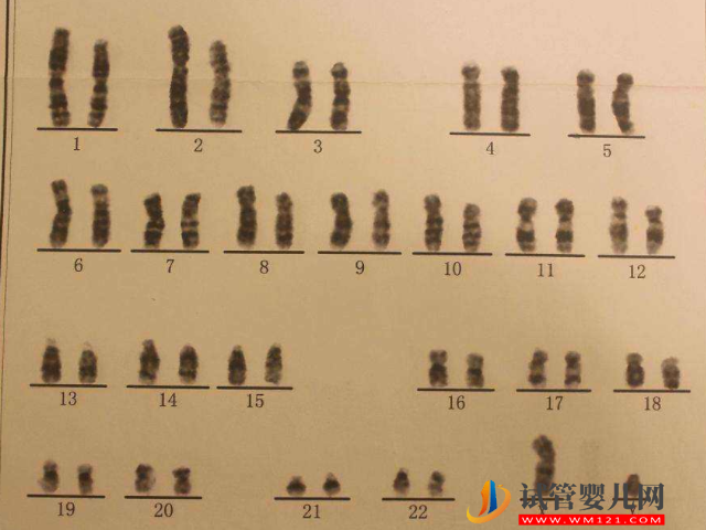 3号染色体控制了脑部神经发育，会影响宝宝的智力(图1)