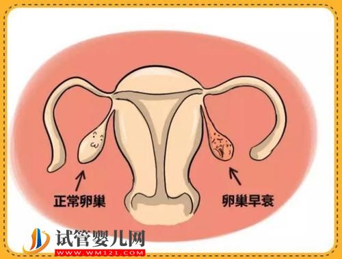 接触有毒金属或致女性卵巢早衰(图1)