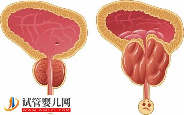 睾酮高有哪些危害(图1)