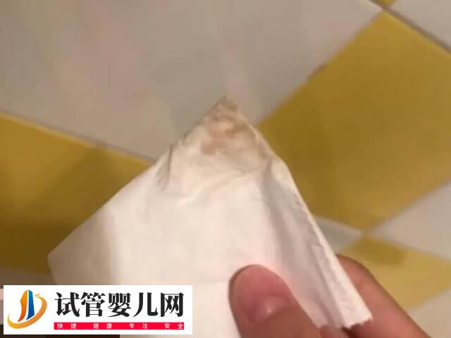 试管期间有褐色分泌物的原因分析，是否正常一篇讲清楚